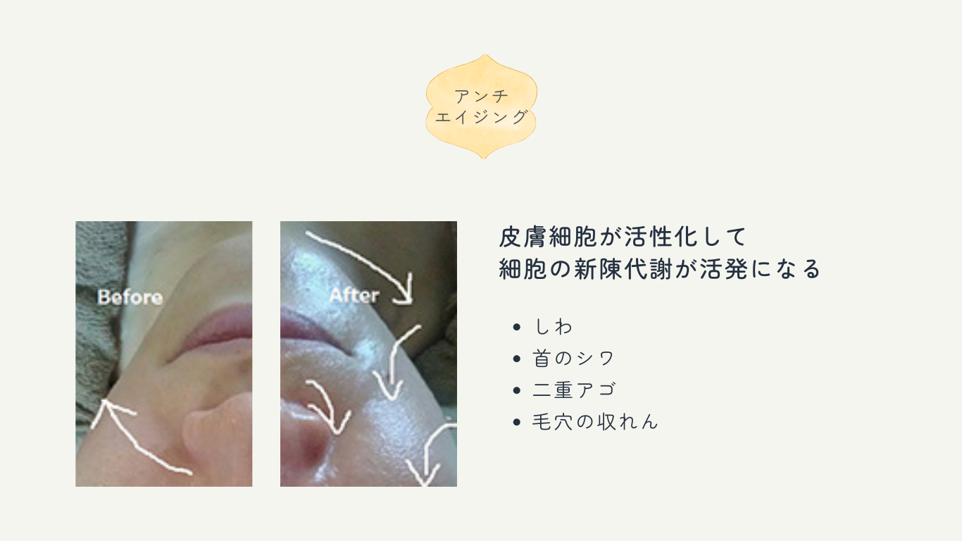 アンチエイジング